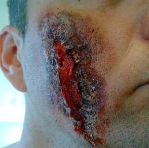Gashes