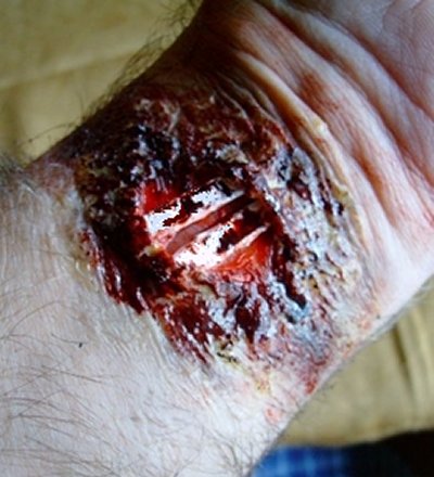 Big Cuts